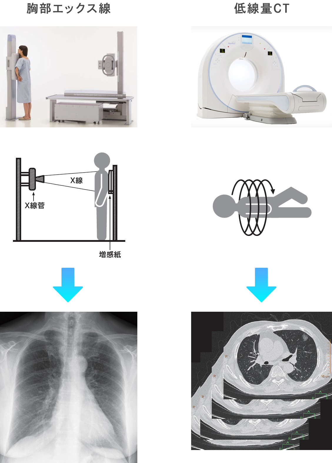 胸部レントゲン順序